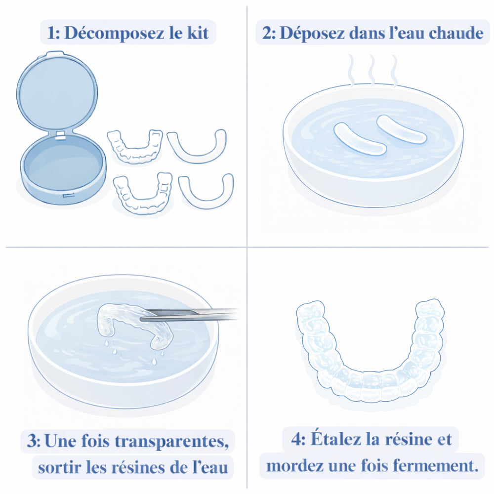 Kit complet de facettes clipsables (haut et bas) Isoria™